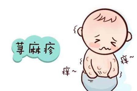 儿童荨麻疹发病时有什么特点呢?