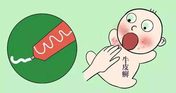 儿童牛皮癣是不是和感染有关呢?
