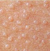 寻常疣患者能否通过检测发现HPV?